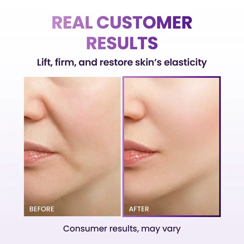 Advanced Anti-Aging Probiotic Facial Night Cream with 17-Peptide Complex for Wrinkles on Face and Neck Nourishing Hydrating Skin Repair Firming Smooth
