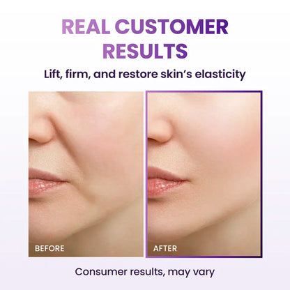 Advanced Anti-Aging Probiotic Facial Night Cream with 17-Peptide Complex for Wrinkles on Face and Neck Nourishing Hydrating Skin Repair Firming Smooth
